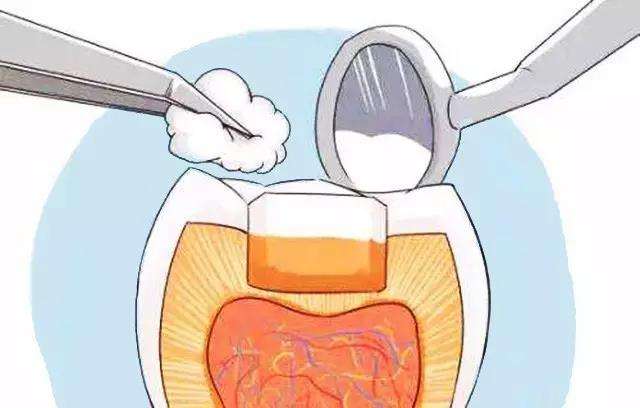 补牙没有那么容易