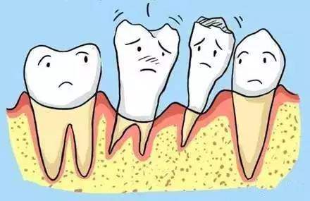 牙周病发生的原因为何？