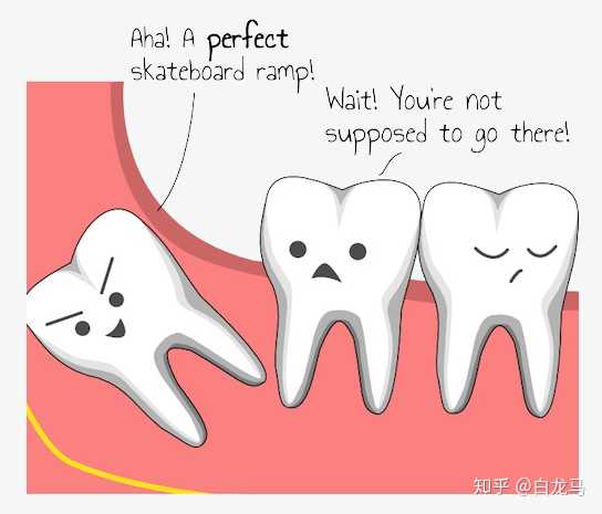 阻生齿要尽早拔除