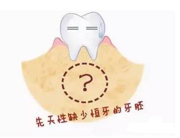 为什么有人先天性缺牙？该怎么办？