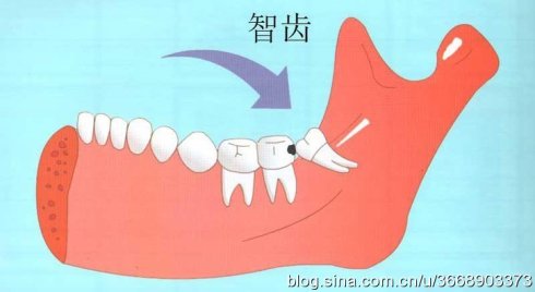 智齿的由来