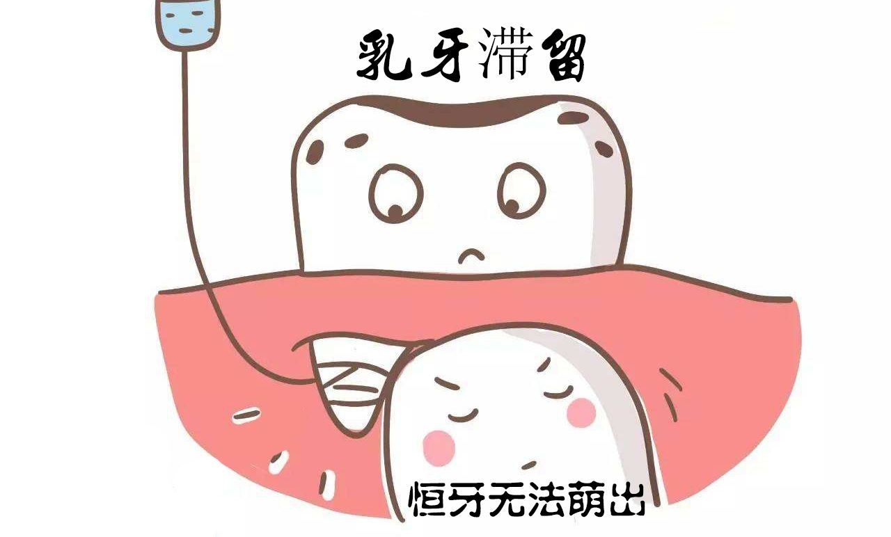 儿童乳牙滞留的常见原因