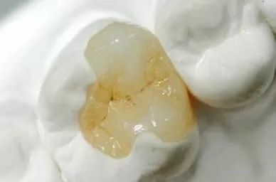 牙体缺损会对哪些组织造成影响