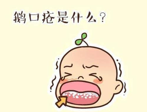 小儿鹅口疮的处理方法是什么