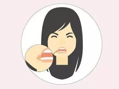 口角炎的预防措施是什么