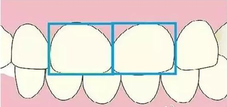 牙齿美学三个要素