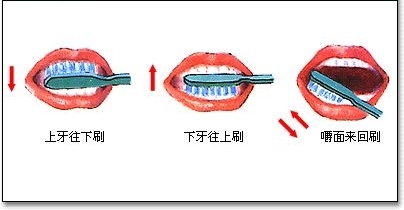 刷牙不当易刷出“沟”来