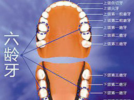 【福州】恒牙的先驱者六龄牙