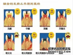 福州补牙过程是怎么样的？需要注意什么？