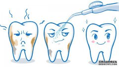 洗牙会破坏牙釉质是真的吗？