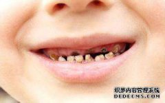 有哪些方法治疗儿童蛀牙呢?