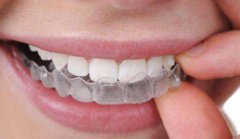 牙齿矫正为什么要复诊？