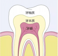 牙齿的保护伞——牙釉质