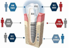 【福州】什么叫做补骨粉?做种植牙都需要用到骨