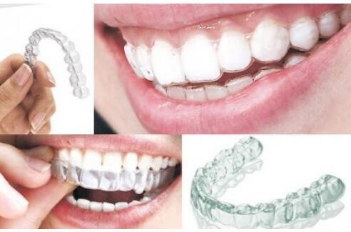 【福州】牙齿矫正选哪种矫正方法好？
