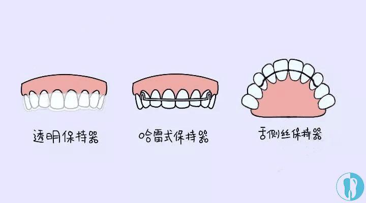 【福州】做完牙齿矫正后保持器需要戴多久？