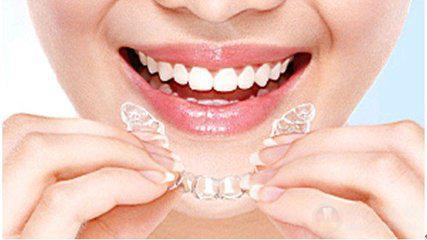 【福州】牙齿矫正选哪种比较好？如何摘戴和保