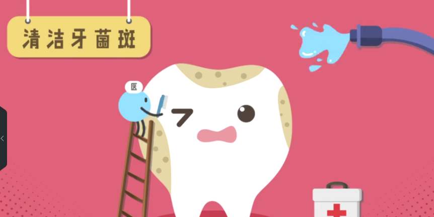 【福州】什么是牙菌斑？该怎么去除它？