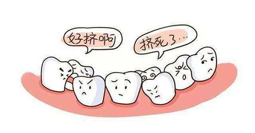 【福州】双排牙是怎么回事？该拔掉吗？