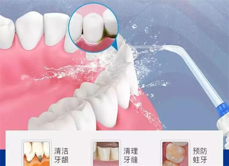 【福州】哪种洗牙方式比较好？