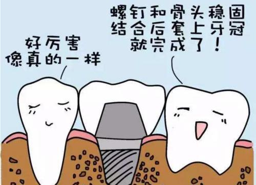 【福州】什么是种植牙？做种植牙会痛吗？