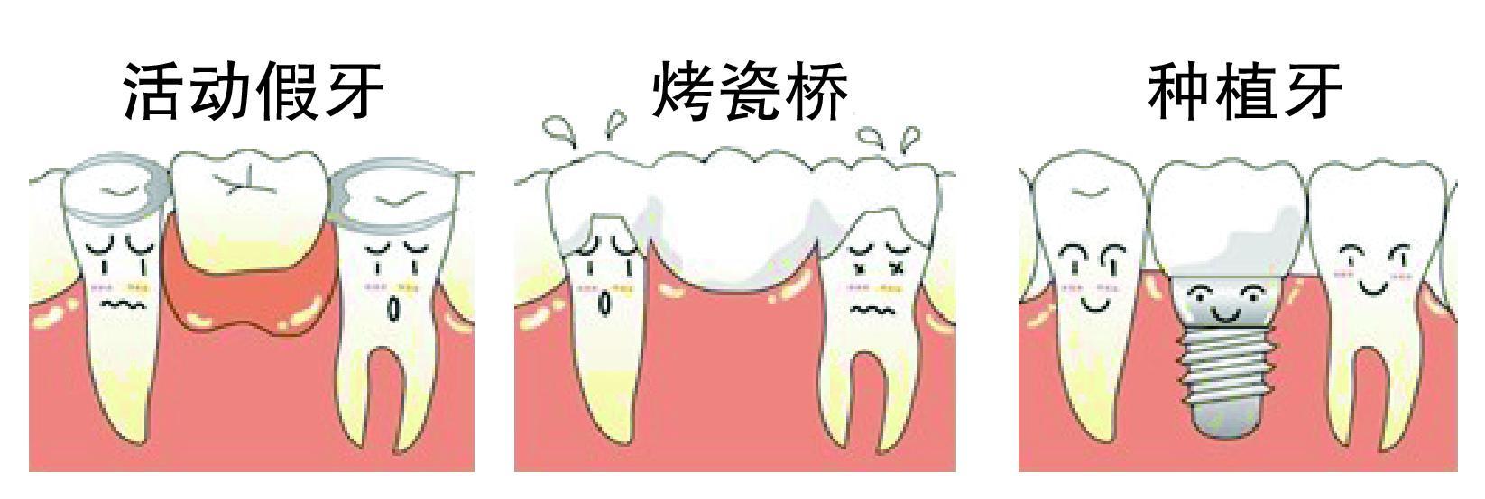 【福州】老年人关于牙齿缺失后进行义齿修复所