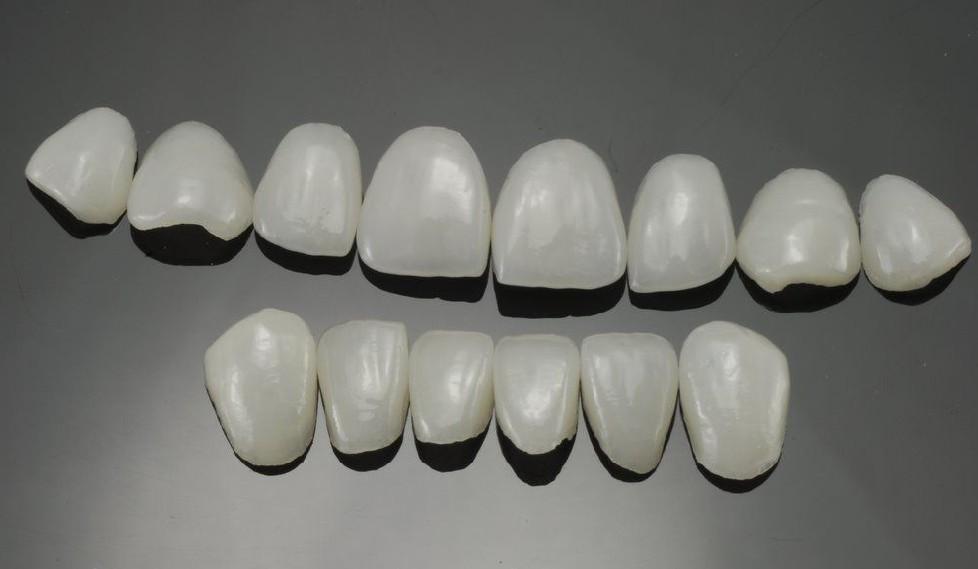 【福州】牙齿有些缺损，还有点黄，做牙齿贴面
