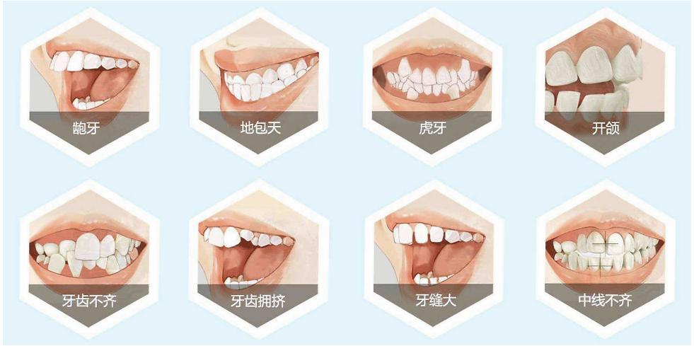 【福州】关于牙齿矫正，您似乎还不知道这些