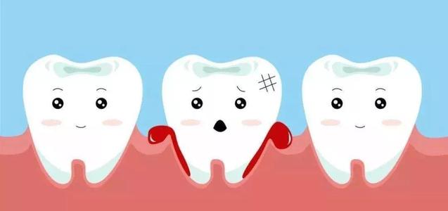 【福州】洗牙是治疗牙周病的好帮手？
