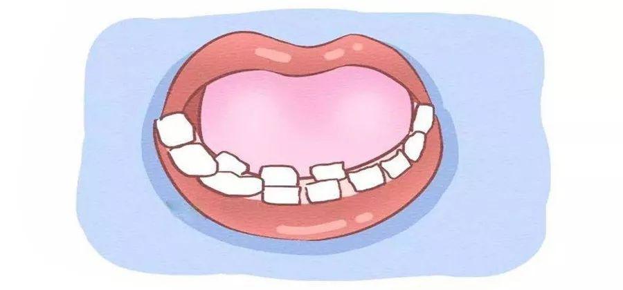 【福州】乳牙滞留是怎么回事？该怎么办？