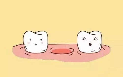 【福州】有哪些情况比较适合做种植牙？