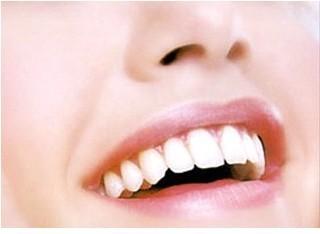 【福州】氟斑牙用哪种牙齿美白方式比较好？