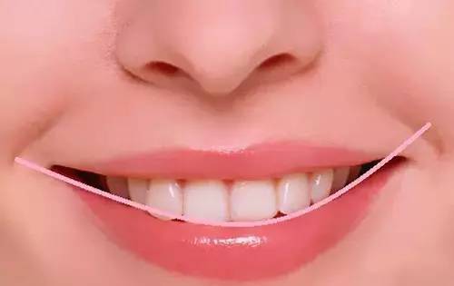 【福州】牙齿畸形为啥非得做矫正？