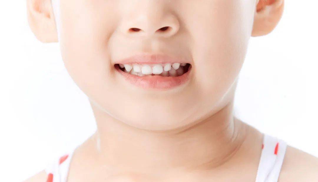 【福州】牙齿不齐到底什么年龄段矫正比较好？