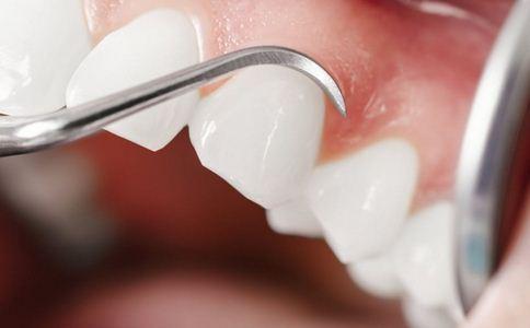 【福州】牙齿松动了吃钙片就能改善？