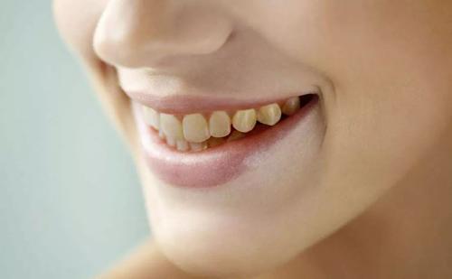 【福州】导致黄牙的原因有哪些？