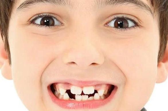 【福州】孩子乳牙坏了就该马上拔掉吗？